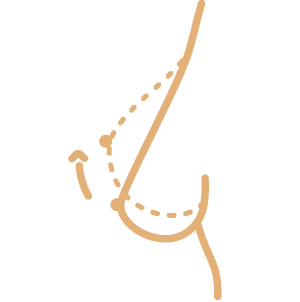 breast