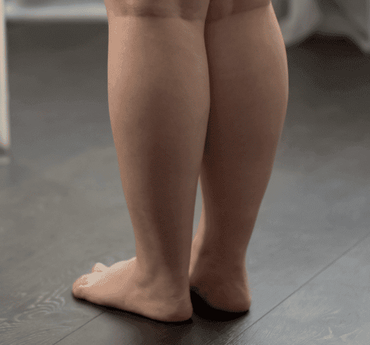 What Are Cankles? Possible Causes and Treatment Options 17 Screen Shot 2022 09 08 at 2.03.43 PM